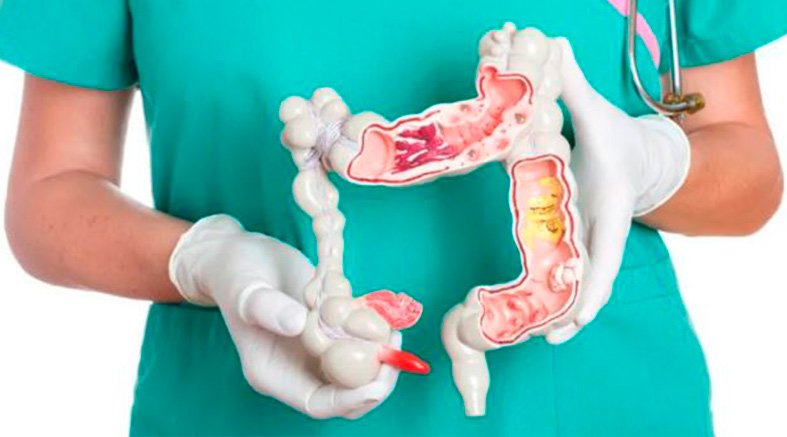 Colorrectal