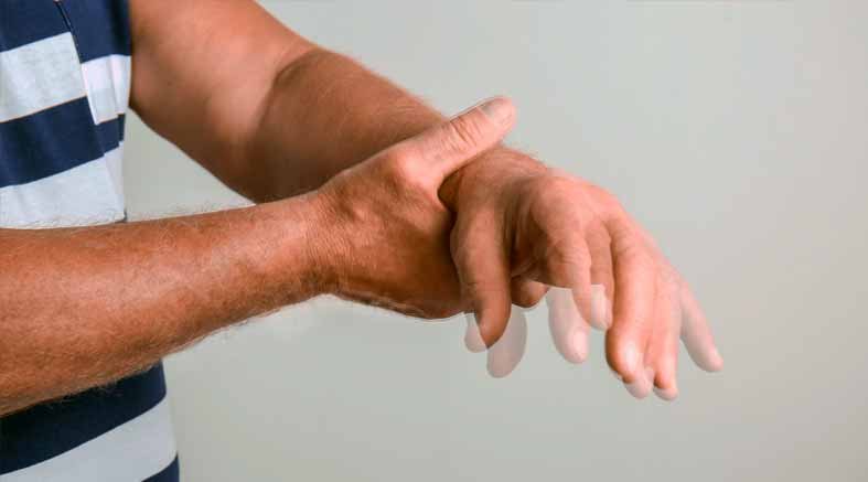 Parkinson